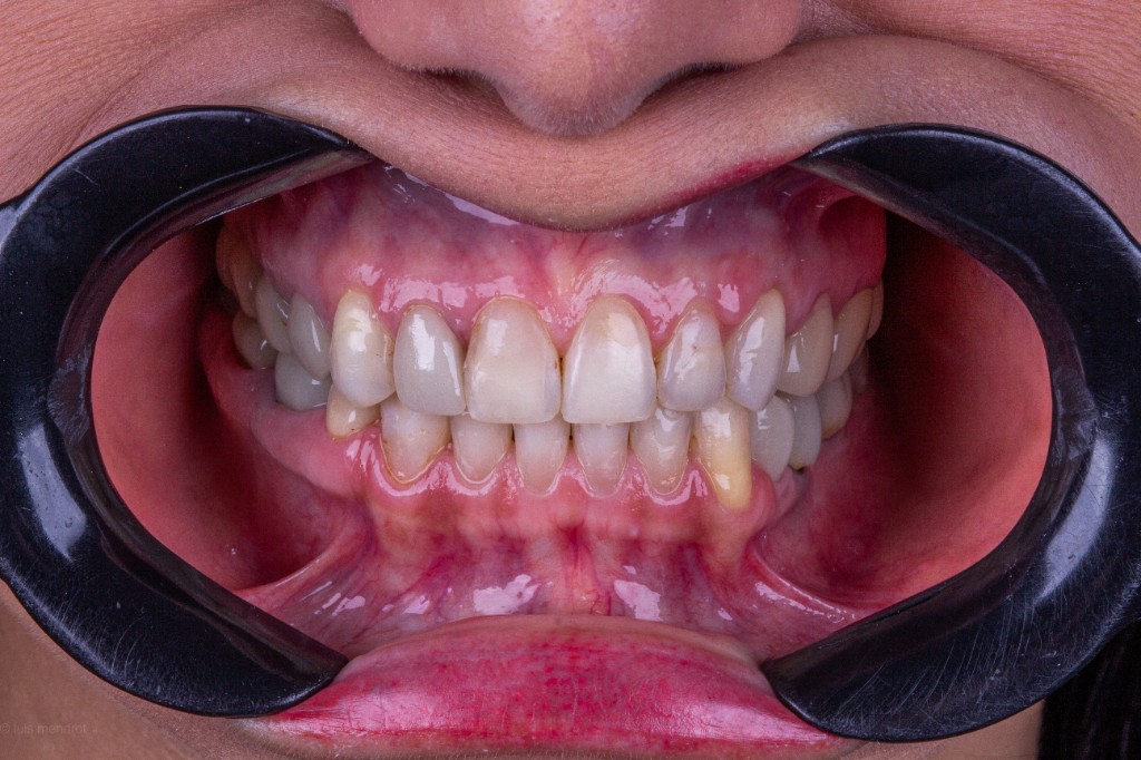 Avaliação clínica e saúde bucal